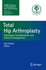 total hip arthroplasty post op,Total Hip Arthroplasty Post-Op: A Comprehensive Guide