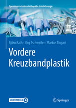 vorderes kreuzband gerissen op,Understanding the Consequences of a Ruptured Anterior Cruciate Ligament: A Personal Journey