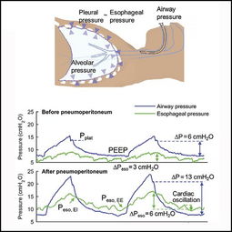 post op care after knee surgery,Understanding the Importance of Post-Op Care After Knee Surgery